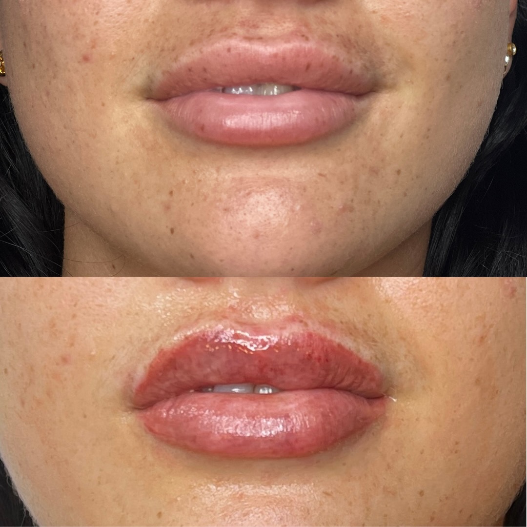 Healed Lip Blush Enhancement